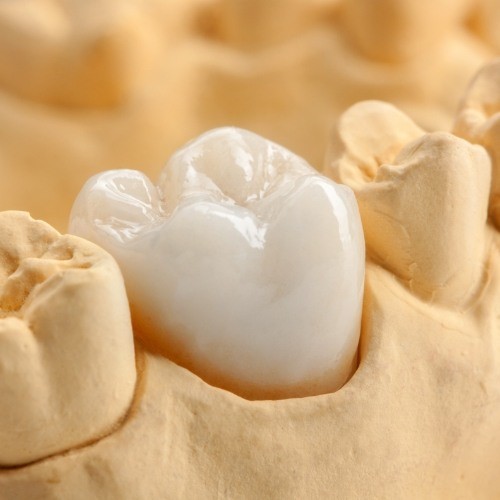 Model of a smile