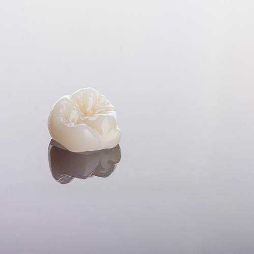 Close-up of a single dental crown