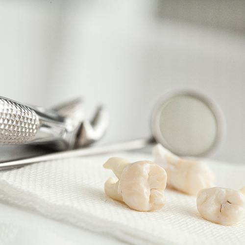 close up of extracted teeth