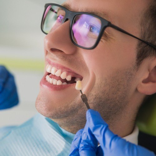 Man with missing tooth compared to replacement tooth color options