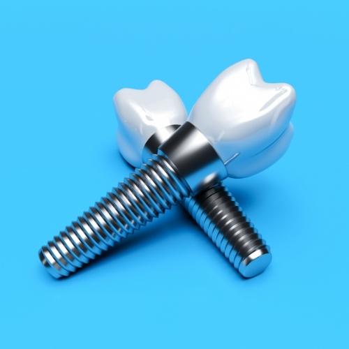 Animated dental implant supported dental crowns