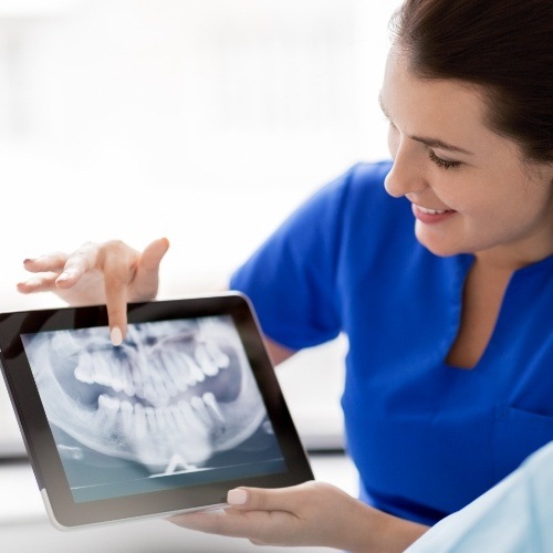Dentist and patient looking at x-rays after cavity detection system screening