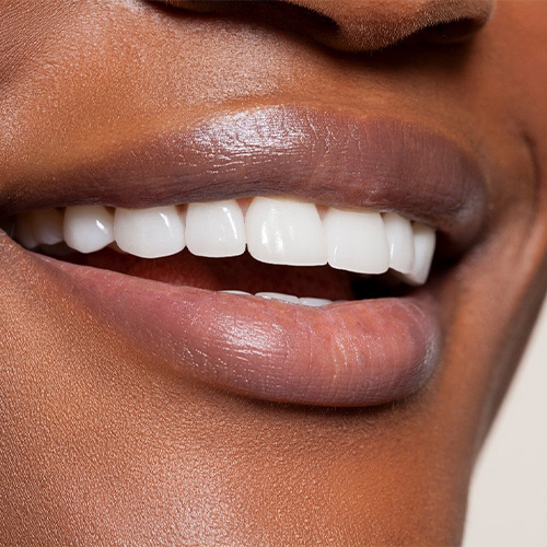 man smiling after getting veneers in Holliston 