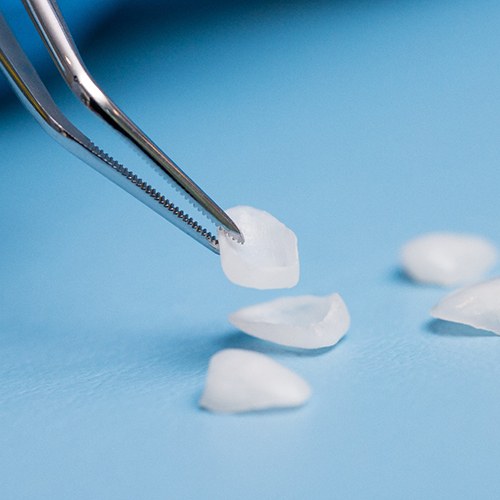 closeup of veneers